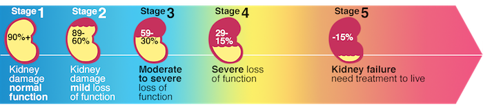 Stages of Kidney Failure